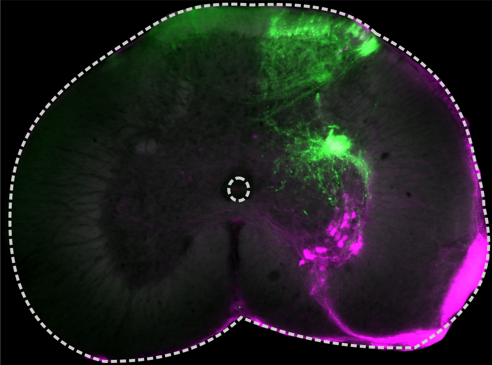backfill of dorsal and ventral root in the rattlesnake SC 