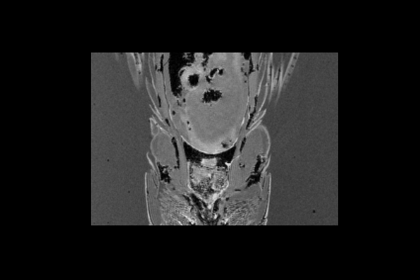 zebrafish pectoral MRI 