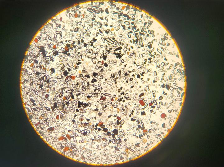 Sample under the microscope ©Skrzypek / Universität Graz