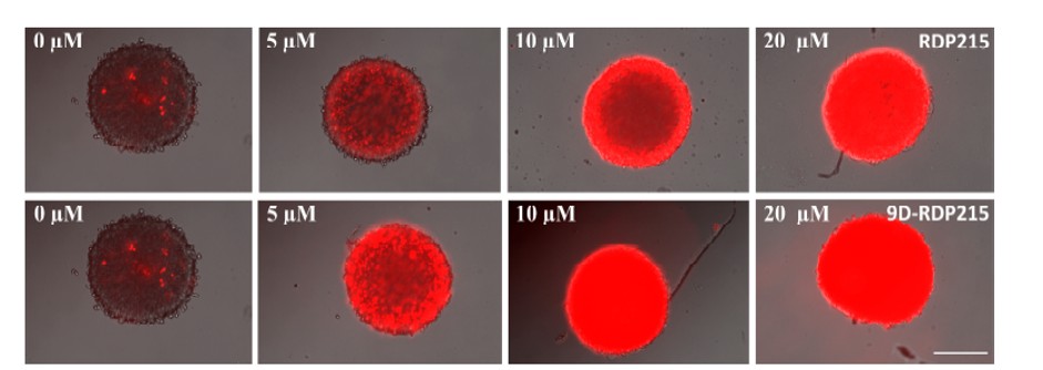 3D Tumorsphäroid Modellstudien an Glioblastom ©Lizenz: CC-BY 4.0