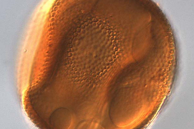 Zyste einer Grünalge der Gattung Pleurozonaria (50 x 50 Mikrometer). Diese Prasinophyte blühte während der frühen Jurazeit. Foto: Bas van de Schootbrugge