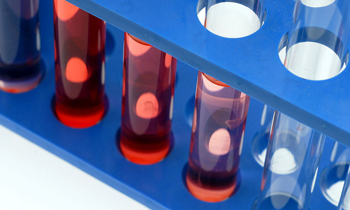 Der Aufklärung der molekularen Ursachen und der Suche nach Diagnose- und Behandlungsmethoden von Fettstoffwechselstörungen widmet sich eine Tagung vom 7. bis 9. April 2016 an der Uni Graz. Foto: Uni Graz/cp-pictures