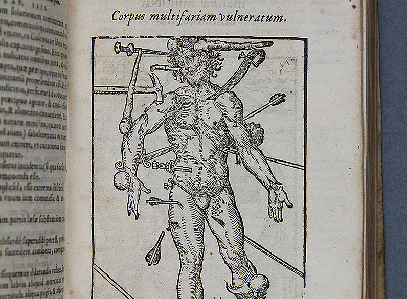 De Chirurgica ©Uni Graz/Restaurierung