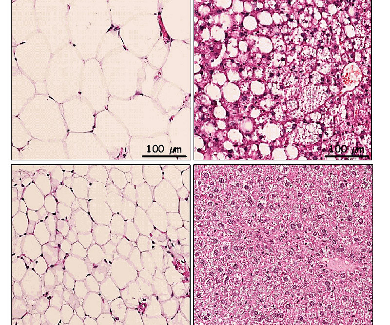 Die Behandlung mit Atglistatin reduziert Fettmasse und verhindert nicht-alkoholische Fettleber trotz fettreicher Ernährung. Foto: Sohsuke Yamada 