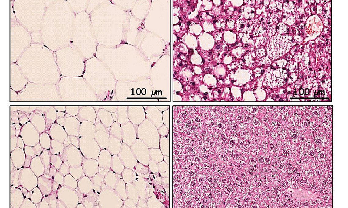 Die Behandlung mit Atglistatin reduziert Fettmasse und verhindert nicht-alkoholische Fettleber trotz fettreicher Ernährung. Foto: Sohsuke Yamada 