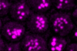 Mit der CARS-Mikroskopie können ForscherInnen minimale Fetttröpfchen - ca. 200 bis 300 Nanometer im Durchmesser - in Hefezellen identifizieren. Diese Methode kam auch bei der aktuellen Kooperation mit der PMU Salzburg, dem Uniklinikum Salzburg und der Stanford University zum Einsatz. Foto: H. Wolinski.