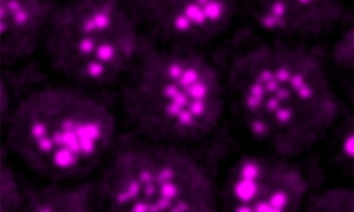 Mit der CARS-Mikroskopie können ForscherInnen minimale Fetttröpfchen - ca. 200 bis 300 Nanometer im Durchmesser - in Hefezellen identifizieren. Diese Methode kam auch bei der aktuellen Kooperation mit der PMU Salzburg, dem Uniklinikum Salzburg und der Stanford University zum Einsatz. Foto: H. Wolinski.