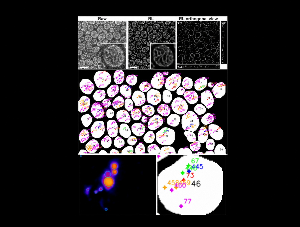 LD size profiling 