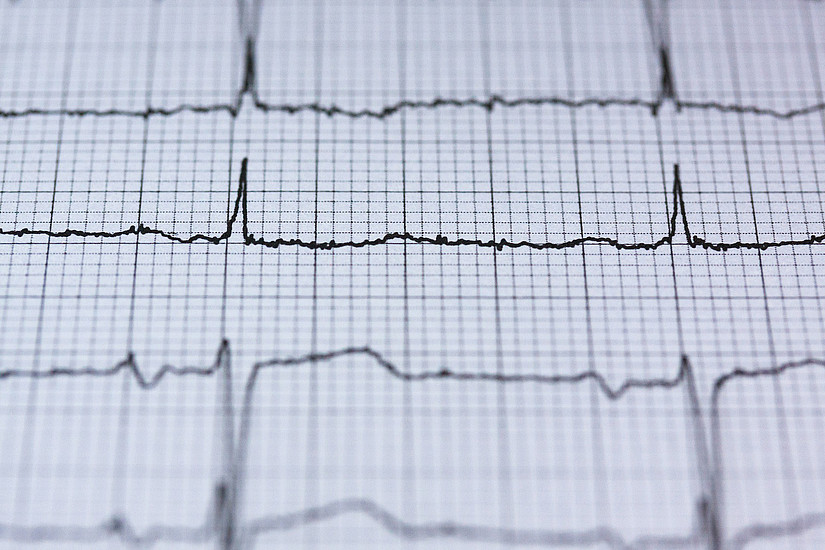 Ein gesundes Herz schlägt nicht ganz regelmäßig. Diese Herzratenvariabilität ist ein Zeichen körperlicher und psychischer Vitalität. Foto: pixabay