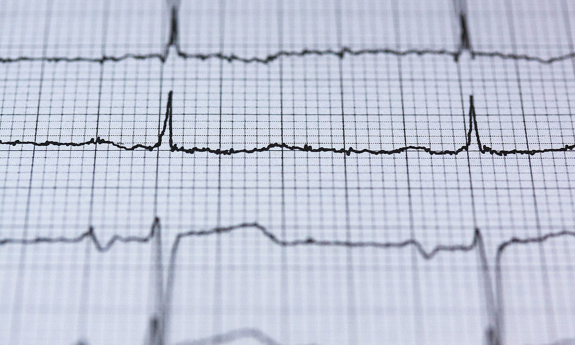 Ein gesundes Herz schlägt nicht ganz regelmäßig. Diese Herzratenvariabilität ist ein Zeichen körperlicher und psychischer Vitalität. Foto: pixabay