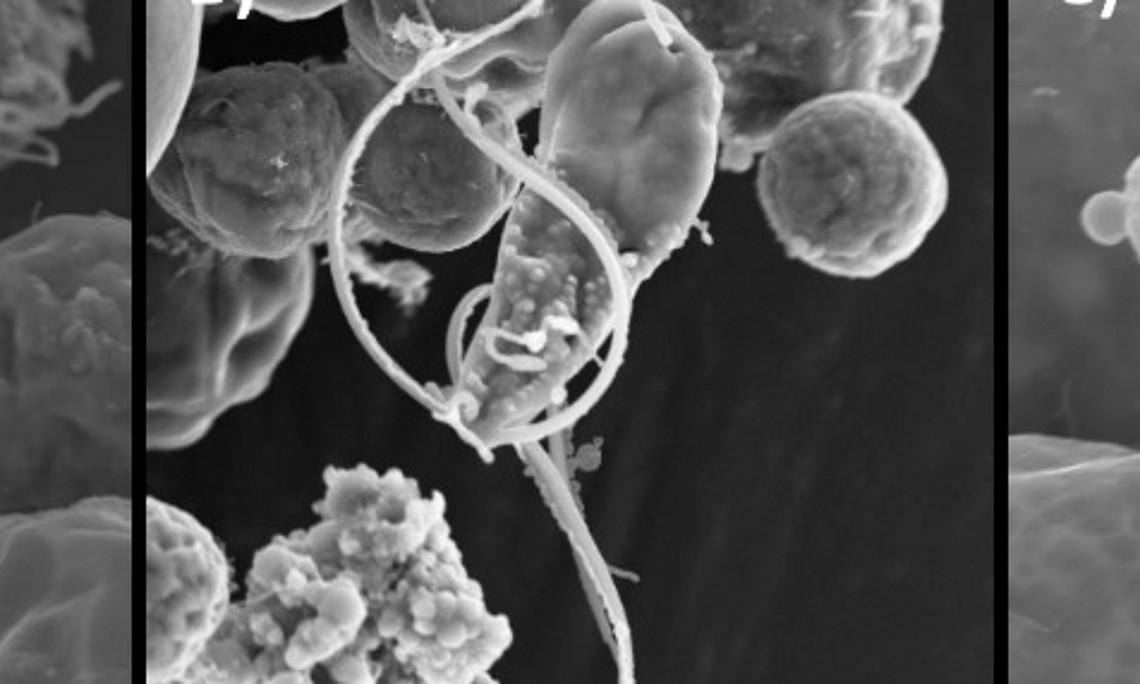 SEM photomicrographs of elongate flagellate cells of Trebouxia angustilobata undergoing cell fusion