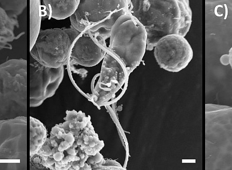 SEM photomicrographs of elongate flagellate cells of Trebouxia angustilobata undergoing cell fusion 
