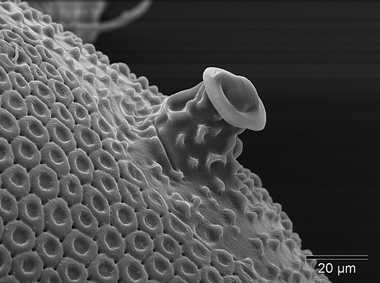 Ihr antibakteriell wirksames Drüsensekret sondert die Hornmilbe "Hermanniella" über ihre schornsteinförmigen Öldrüsen-Ausführporen ab. Foto: Edith Stabentheiner.