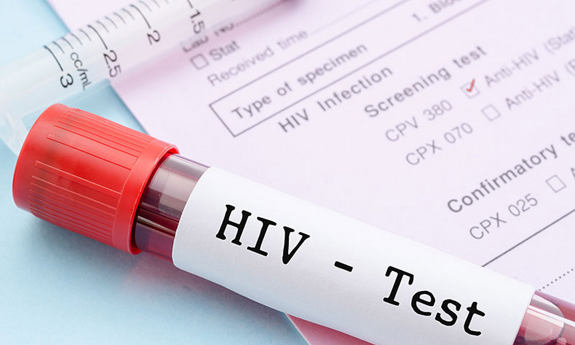 Sexuell übertragbare Krankheiten, wie etwa HIV, sind weltweit auf dem Vormarsch. Foto: Gam1983/shutterstock.com