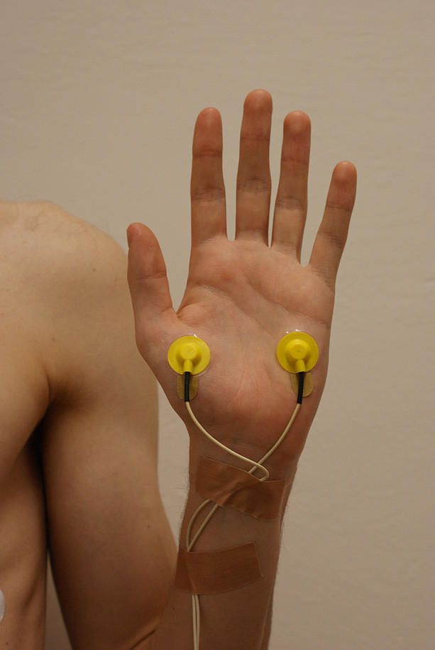 VarioPort EDA electrodes on hand ©GesPsy / Universität Graz