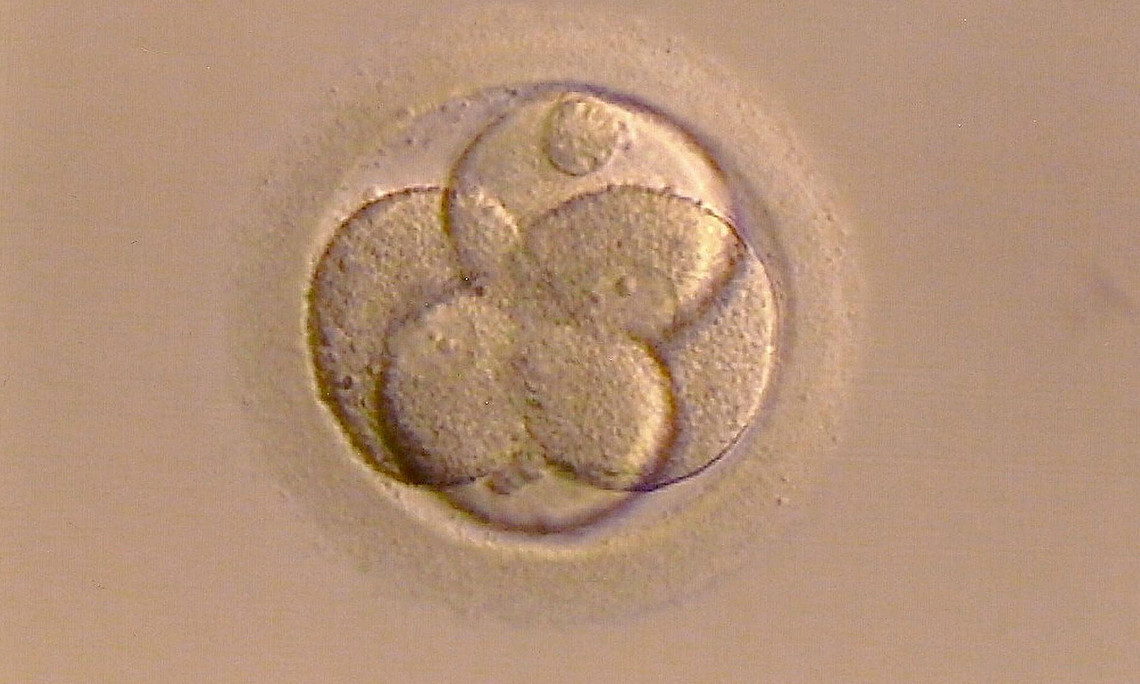 Befruchtete Eizelle