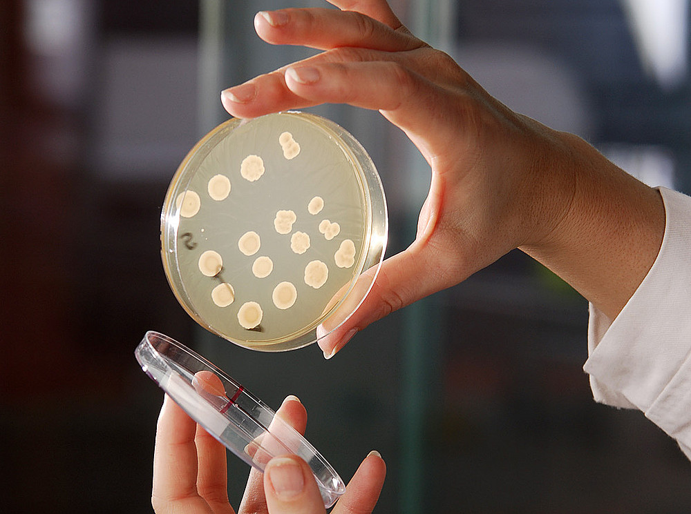 eine Hand hält eine Petrischale mit ver. Kulturen in das Licht ©ZMB
