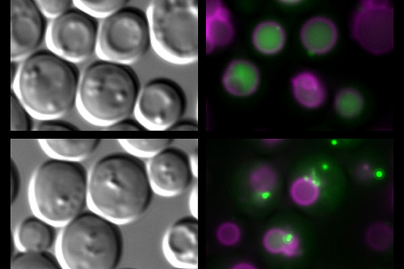 Die Abbildung zeigt alternde Hefezellen im Lichtmikroskop (links). Durch Fluoreszenzfärbungen (rechts) wurde der „Magen“ der Zellen (die sog. Vakuole) sichtbar gemacht (Magenta färbig). In gesunden Zellen können Proteine, die mittels grüner Fluoreszenz markiert wurden, durch Autophagie recycelt werden (oben rechts). Zellen mit gestörtem Fettstoffwechsel (unten rechts) zeigen einen Autophagiedefekt und scheitern beim Transport der grün-markierten Proteine in die Vakuole und Altern schneller. Bild: Uni Graz/Eisenberg
