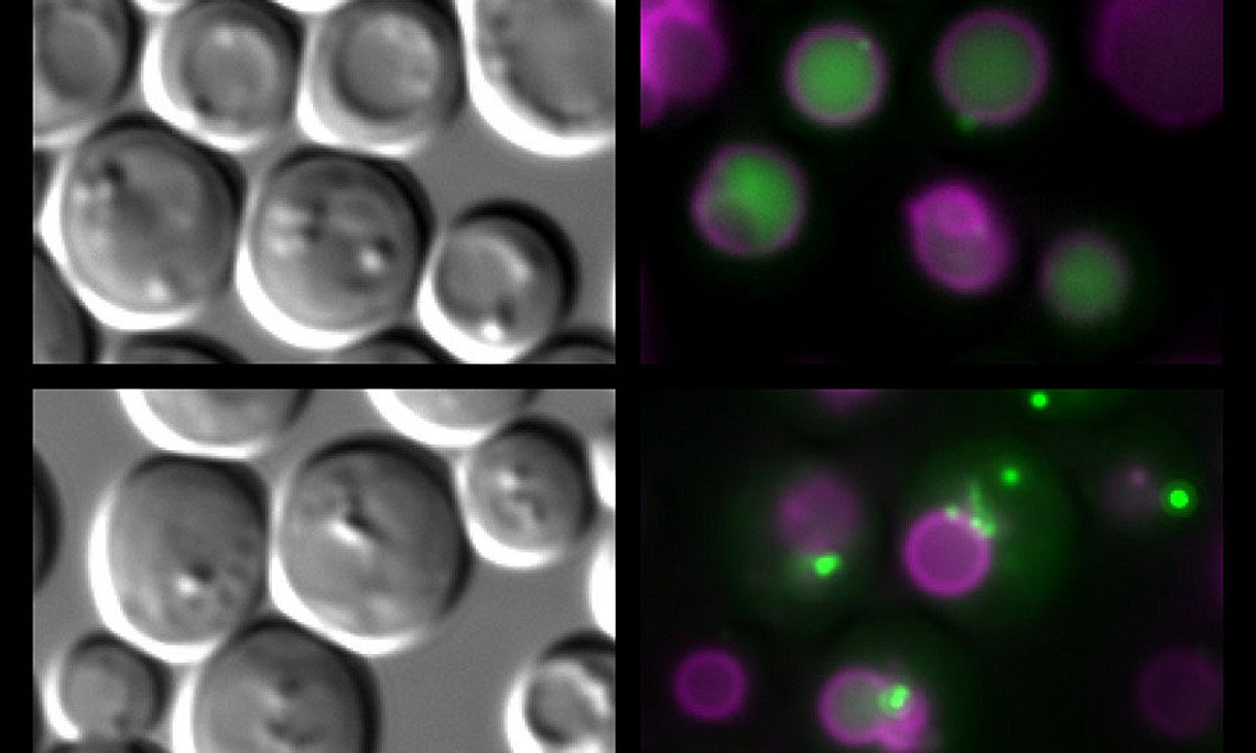 Die Abbildung zeigt alternde Hefezellen im Lichtmikroskop (links). Durch Fluoreszenzfärbungen (rechts) wurde der „Magen“ der Zellen (die sog. Vakuole) sichtbar gemacht (Magenta färbig). In gesunden Zellen können Proteine, die mittels grüner Fluoreszenz markiert wurden, durch Autophagie recycelt werden (oben rechts). Zellen mit gestörtem Fettstoffwechsel (unten rechts) zeigen einen Autophagiedefekt und scheitern beim Transport der grün-markierten Proteine in die Vakuole und Altern schneller. Bild: Uni Graz/Eisenberg