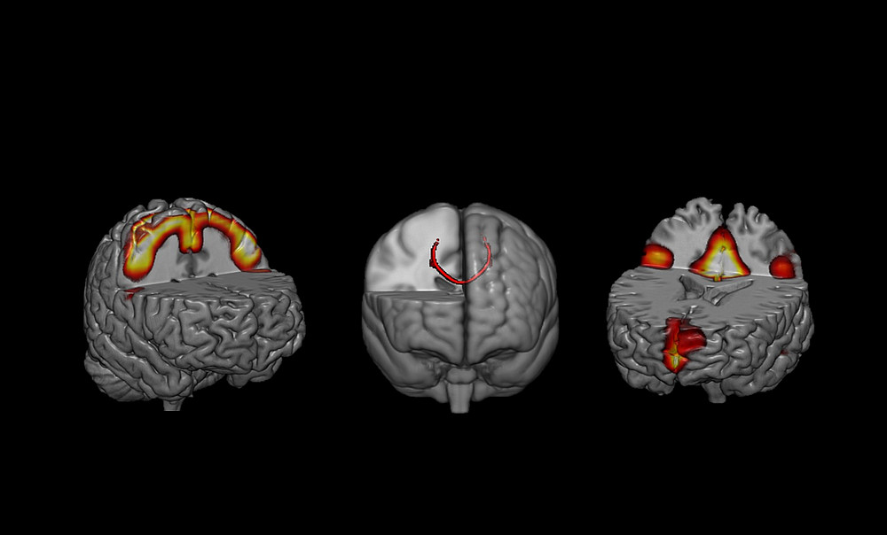 fMRI scan ©Ferreira Marins, Theo, Ph.D