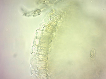 Endothecium seitlich ©UniGraz/Miriam Zehentner