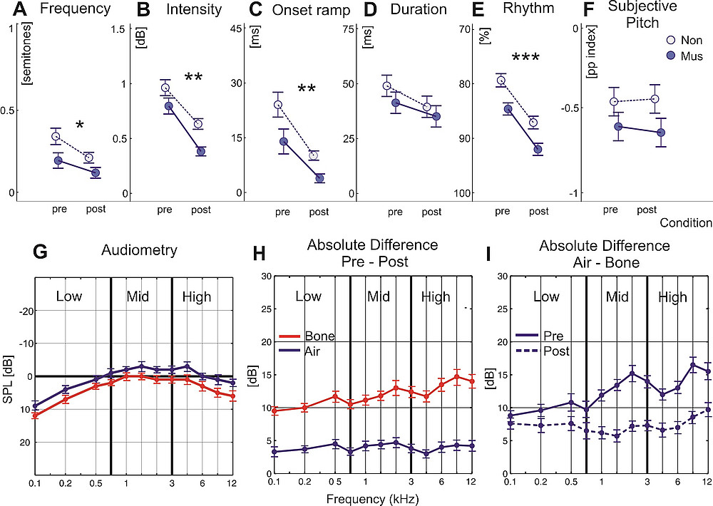 Kurzzeitplastizität auditiver Fähigkeiten ©Schneider, P., Groß, C., Bernhofs, V., Christiner, M., Benner, J., Turker, S., ... & Seither‐Preisler, A. (2022).