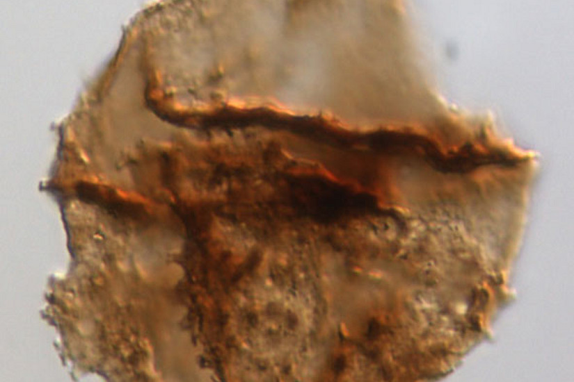 Zyste einer Rotalge der Gattung Rhaetogonyaulax (40 x 60 Mikrometer). Dinoflagellaten waren häufiger, bevor das Massensterben während der späten Trias einsetzte. Foto: Bas van de Schootbrugge.