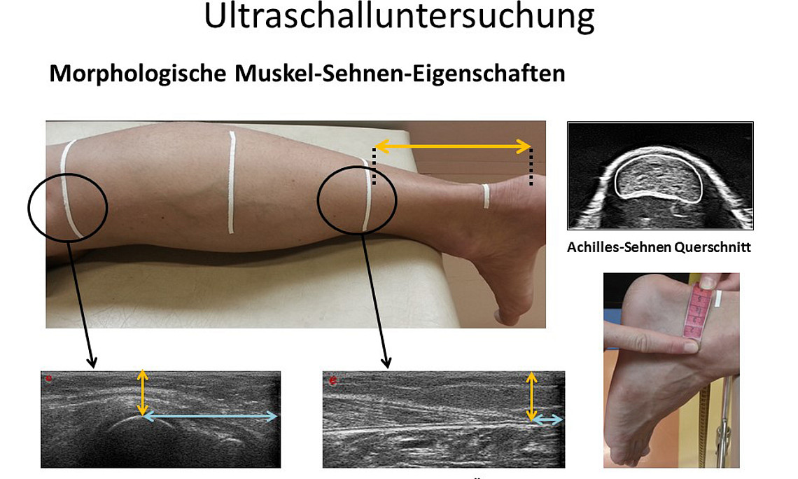 Mithilfe von Ultraschall wurde das elementare Zusammenspiel von Muskel und Sehne beobachtet. Fotos: Uni Graz/Annika Kruse