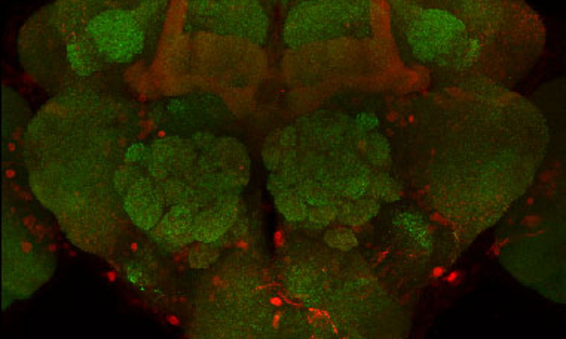 Mikroskopische Fluoreszenz-Aufnahme eines Drosophila-Gehirns von gealterten Fliegen, die an Morbus Parkinson leiden. Es sind sowohl synaptische Verbindungen zwischen den Nervenzellen (grün) als auch die krankheitsauslösenden Proteine (rot) dargestellt.