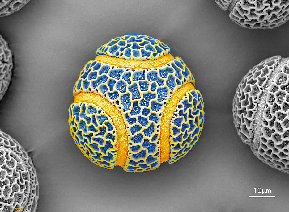 Pollenkorn einer Passionsblume im Elektronenmikroskop 