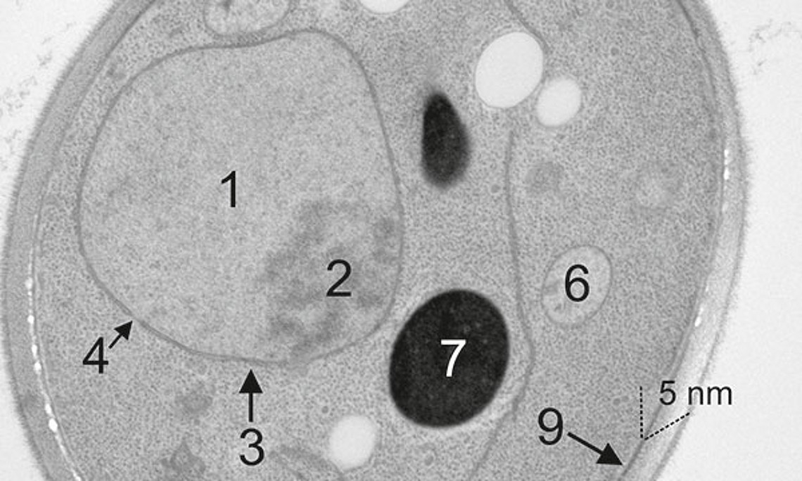 Elektronenmikroskopie einer Hefezelle: 1 Zellkern (Nucleus); 2 Kernkörperchen (Nukleolus); 3 Kernmembran; 4 Kernpore; 5 Lipidtropfen (Speicherfett); 6 Mitochondrium; 7 Vacuole; 8 Endoplasmatisches Retikulum; 9 Plasmamembran; 10 Zellwand. Eine Hefezelle h