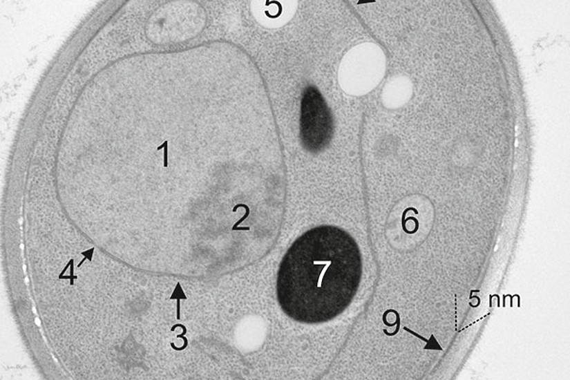 Elektronenmikroskopie einer Hefezelle: 1 Zellkern (Nucleus); 2 Kernkörperchen (Nukleolus); 3 Kernmembran; 4 Kernpore; 5 Lipidtropfen (Speicherfett); 6 Mitochondrium; 7 Vacuole; 8 Endoplasmatisches Retikulum; 9 Plasmamembran; 10 Zellwand. Eine Hefezelle h