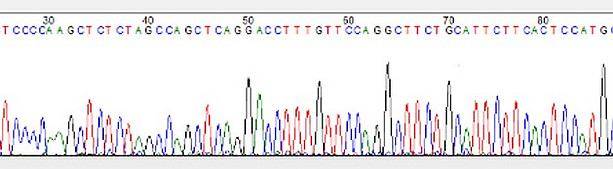 dna sequence 