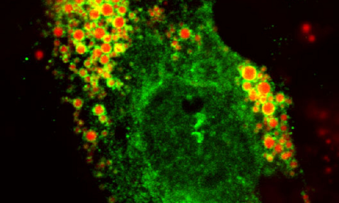 Fluoreszenzmarkiertes G0S2 (grün) auf der Oberfläche von gespeicherten Lipidtröpfchen (rot) in einer kultivierten Herzzelle, aufgenommen mit einem konfokalen Fluoreszenzmikroskop. Foto: Uni Graz/IMB