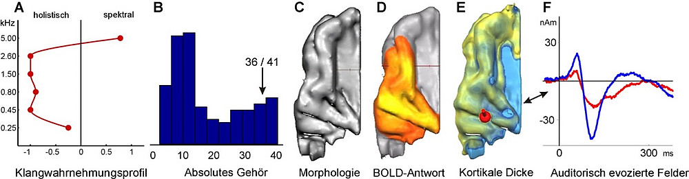 Abb. 3 ©Schneider, P., Benner, J., Zeidler, B., Christiner, M., Seither-Preisler, A., & Engelmann, D. (2018).