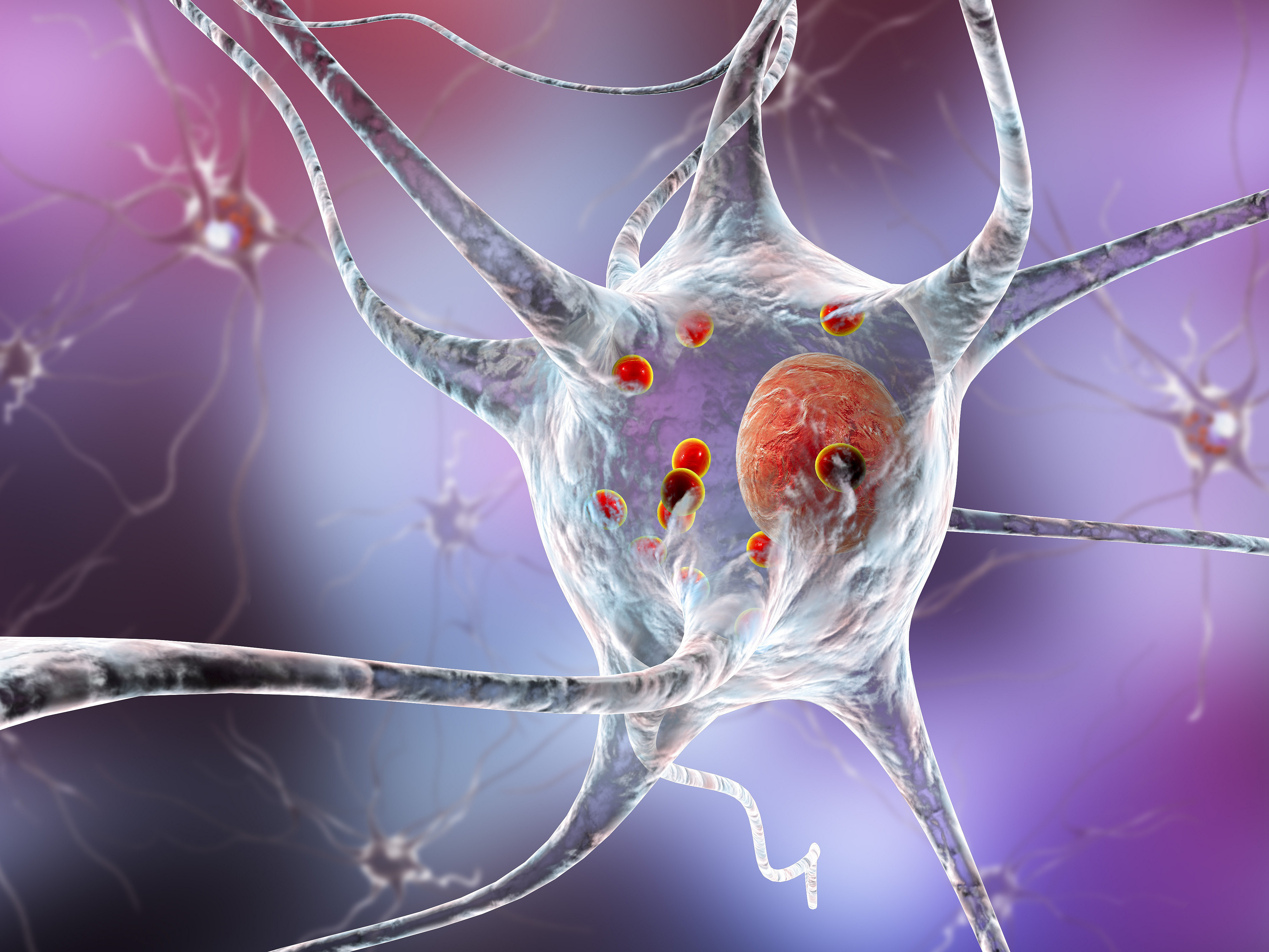 Neurodegenerative Erkrankungen, wie zum Beispiel Parkinson, können entstehen, wenn der Fettstoffwechsel des Gehirns in ein Ungleichgewicht fällt. ForscherInnen der Universität Graz und der Harvard Medical School haben nun herausgefunden, dass die Hemmung eines bestimmten Enzyms neurodegenerative Prozesse unterdrückt. Bild: shutterstock/Kateryna Kon 