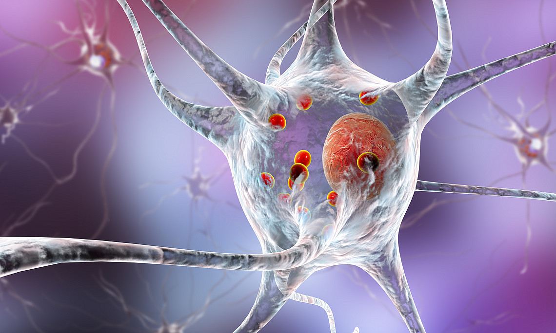 Neurodegenerative Erkrankungen, wie zum Beispiel Parkinson, können enstehen, wenn der Fettstoffwechsel des Gehirns in ein Ungleichgewicht fällt. ForscherInnen der Universität Graz und der Harvard Medical School haben nun herausgefunden, dass die Hemmung eines bestimmten Enzyms neurodegenerative Prozesse unterdrückt. Bild: shutterstock/Kateryna Kon