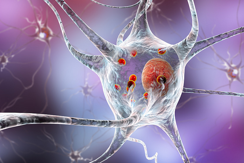 Neurodegenerative Erkrankungen, wie zum Beispiel Parkinson, können enstehen, wenn der Fettstoffwechsel des Gehirns in ein Ungleichgewicht fällt. ForscherInnen der Universität Graz und der Harvard Medical School haben nun herausgefunden, dass die Hemmung eines bestimmten Enzyms neurodegenerative Prozesse unterdrückt. Bild: shutterstock/Kateryna Kon