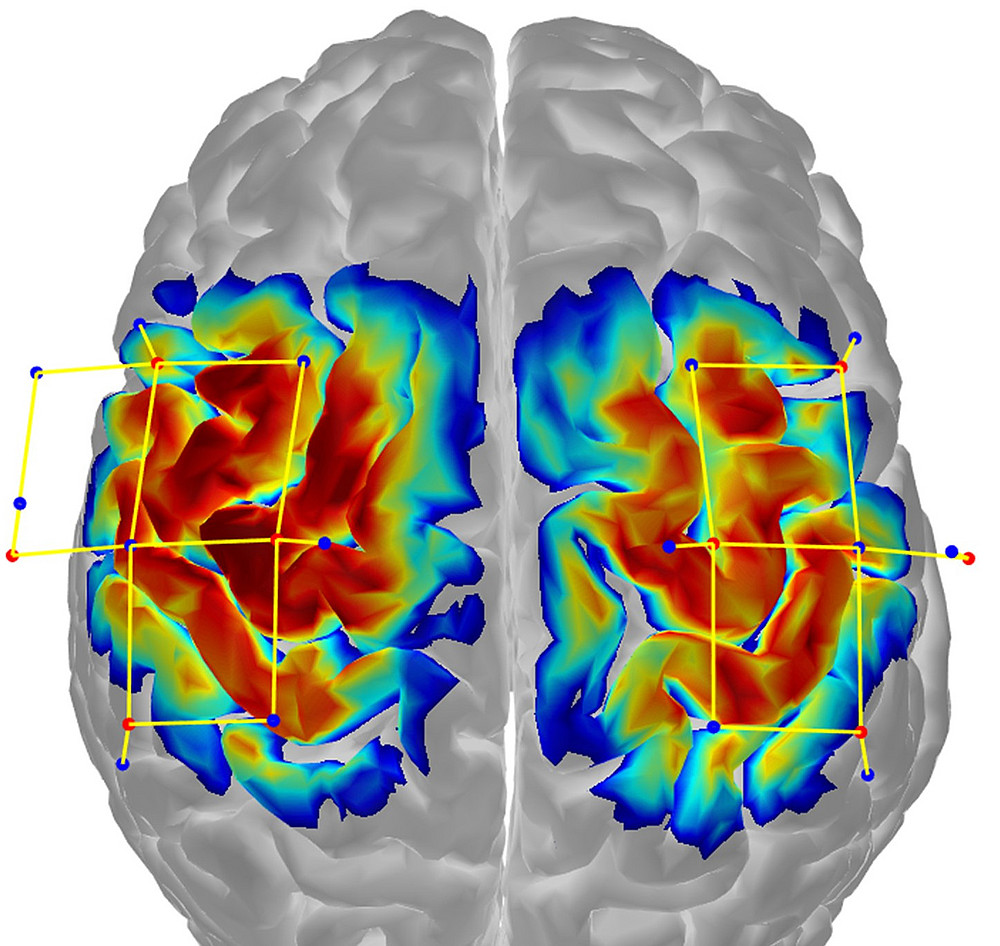 Schematische Darstellung eines Gehirns mit kortikalen Aktivierungsmustern ©Silvia Kober
