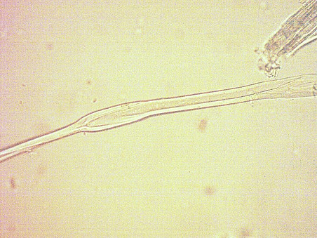 plantaginis ©Uni Graz/Franz Bucar