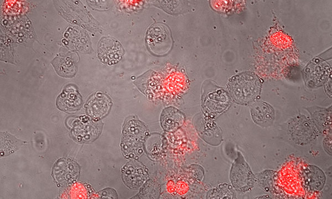 Mit dem Antitumor-Peptid behandelte Hautkrebszellen: Auf Bläschenbildung folgen starke Membranschädigungen und Zelltod (rot). Foto: Uni Graz/Riedl