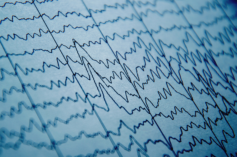 EEG wave 