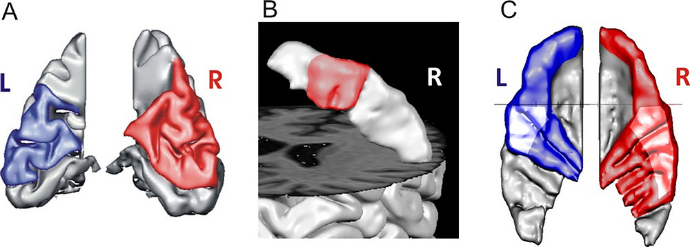 Abb. 4 ©Schneider, P., Benner, J., Zeidler, B., Christiner, M., Seither-Preisler, A., & Engelmann, D. (2018).