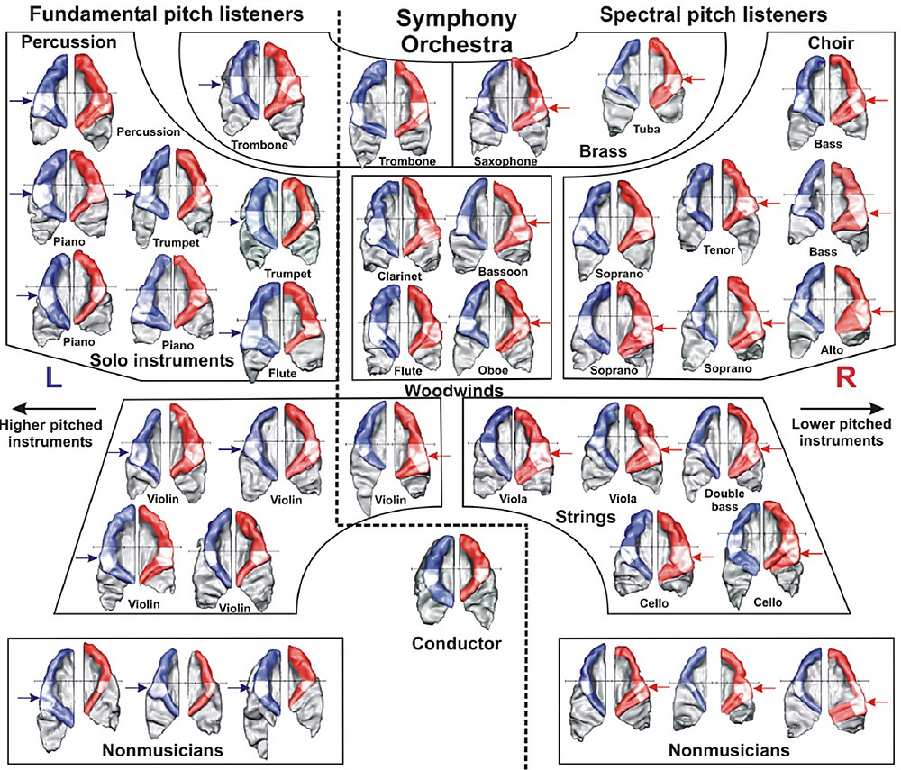 Fig. 2 ©Schneider, P., Sluming, V., Roberts, N., Bleeck, S., & Rupp, A. (2005). 