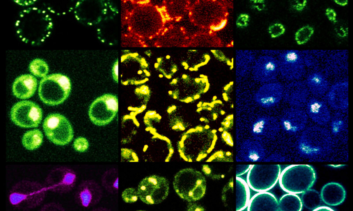Das Bild zeigt verschiedene zelluläre Strukturen der Hefe, die alle von Membranen umschlossen sind. Bei der Zellteilung werden diese Strukturen verdoppelt, was die Synthese entsprechender Membran-Lipide voraussetzt.