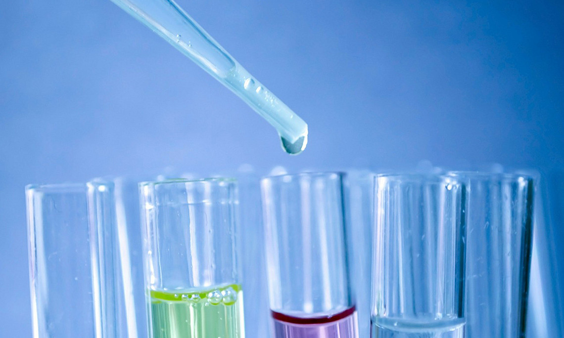Reagenzgläser und Pipette Foto: Pixabay