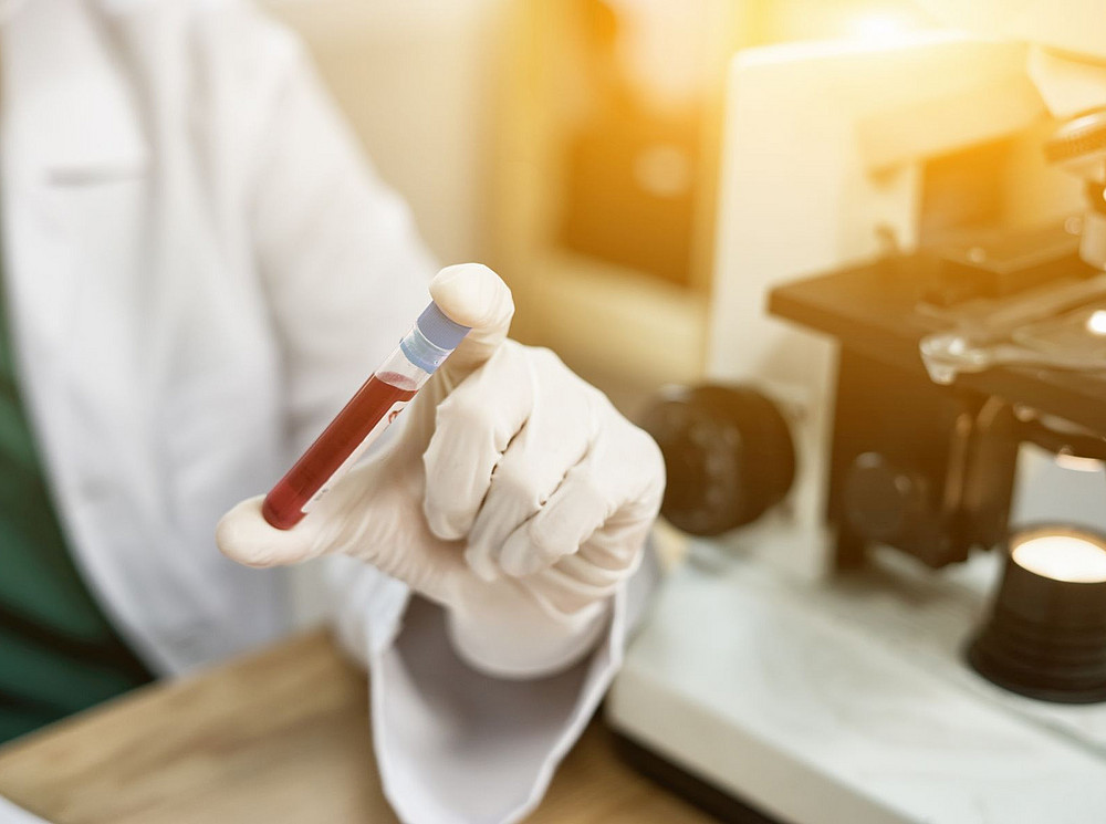 Person in lab coat holds test tube filled with red liquid in hand ©Have a nice day - stock.adobe.com