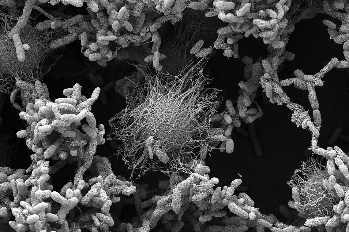 Verschiedene Arten von Bakterien (zylindrisch) und ein Pilz interagieren miteinander. Foto: William Lopes, CMM-UFRGS (Center for Microscopy and Microanalysis at Universidade Federal do Rio Grande do Sul), Brazil