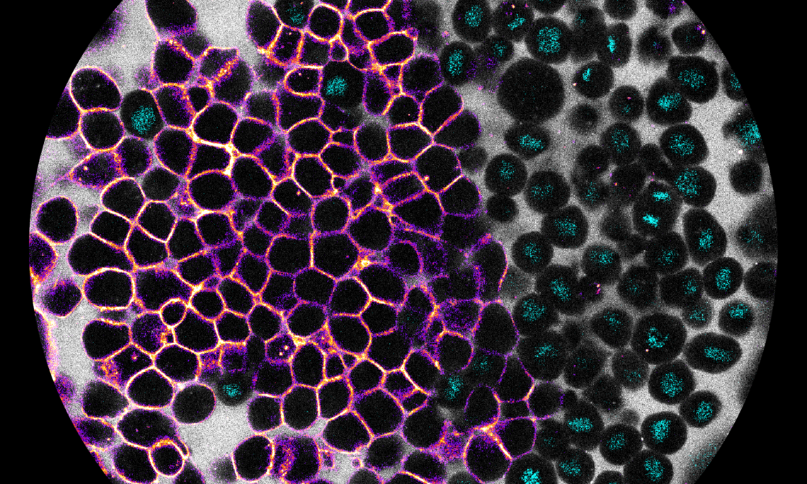 Confocal microscopy time-lapse movie of a developing zebrafish embryo, as the marginal cells change fate. Cell membranes are shown in gray, cell nuclei in yellow, and the mesendodermal fate marker sebox in magenta. 