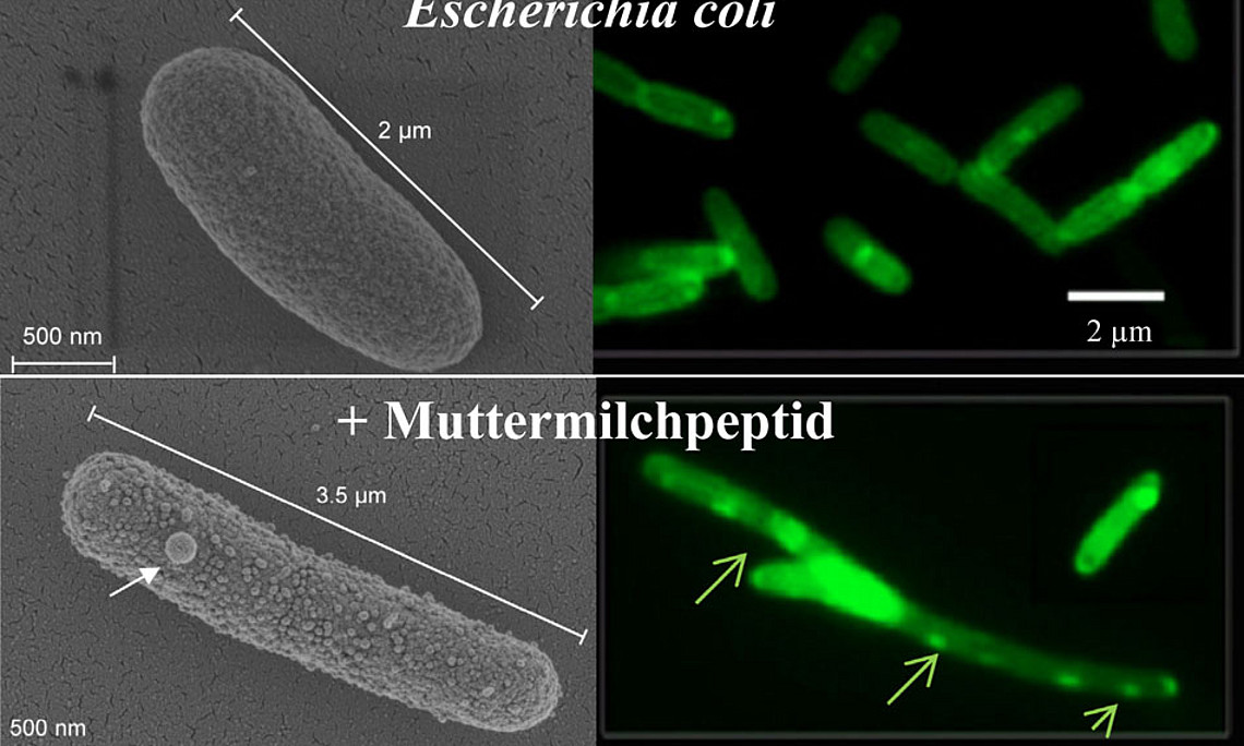 Elektronenmikroskopie (links) und Fluoreszenzmikroskopie (rechts): Aufnahmen von Zellen des Bakteriums Escherichia coli ohne Einwirkung von Peptid (oben) und unter Einwirkung einer mit Fettsäureketten verstärkten Variante des Muttermilchpeptids Lactofer